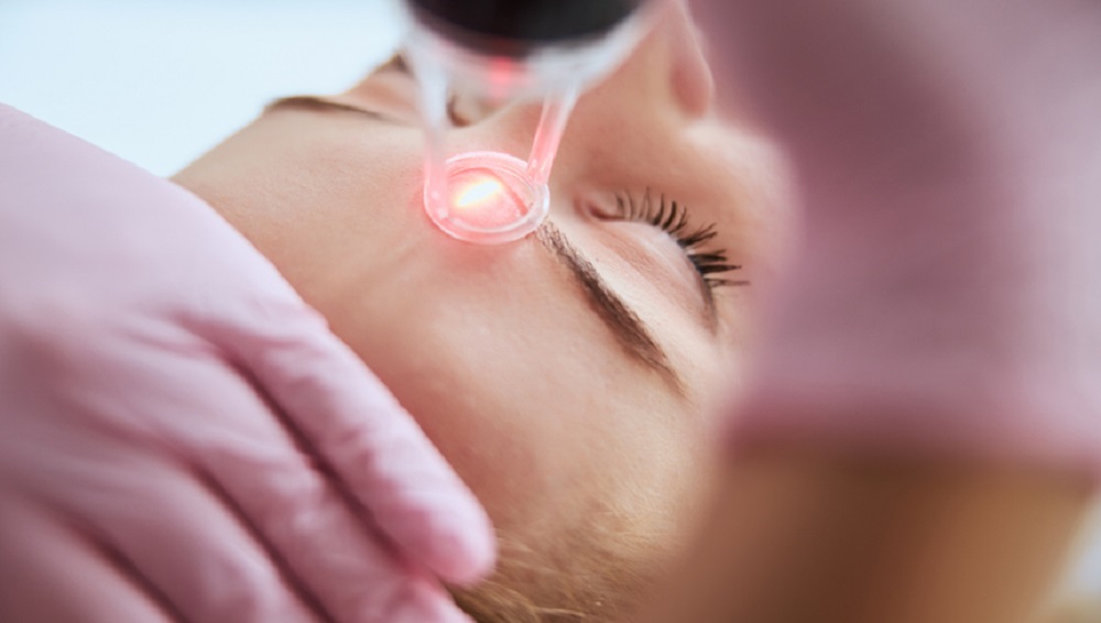 Fotona Laser for Pigmentation: A Guide for Advanced Users