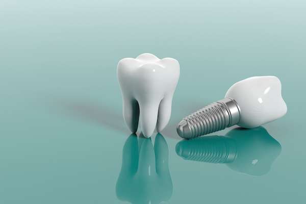 dental implants